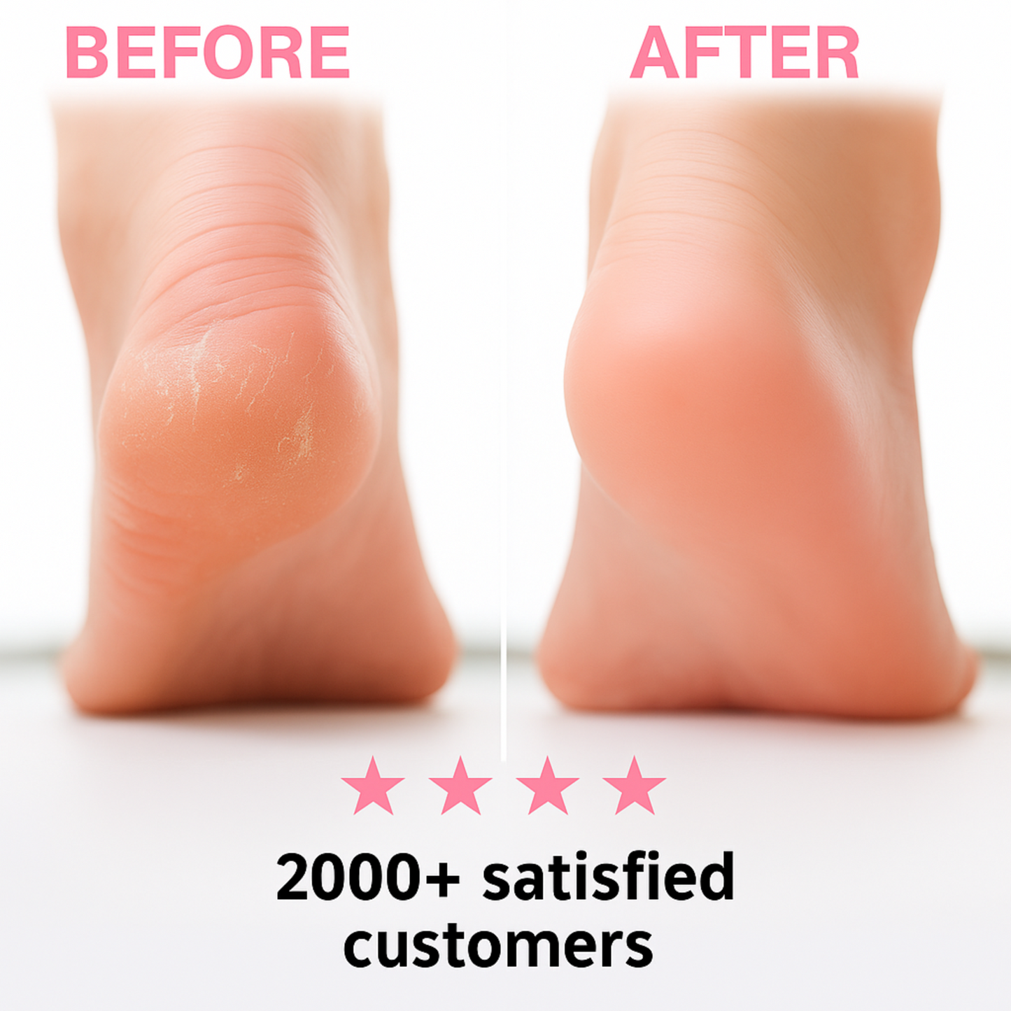 SmoothPro Foot Smoother