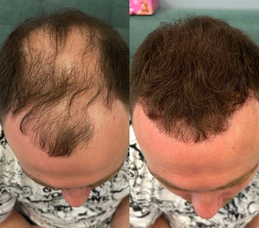 Apex Hair