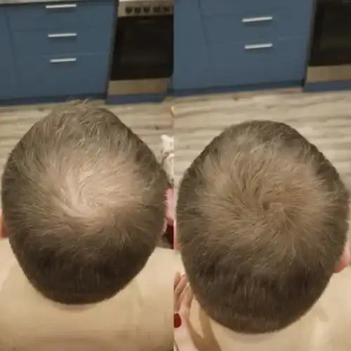 Apex Hair