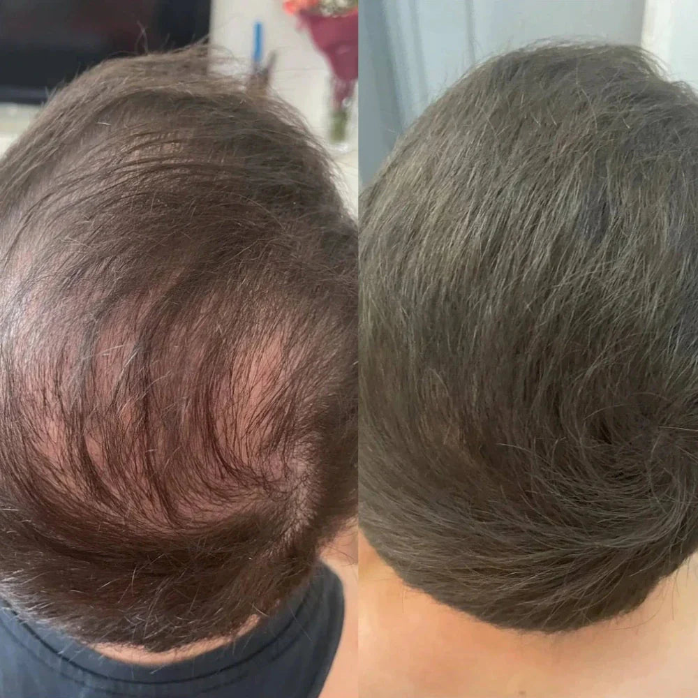 Apex Hair