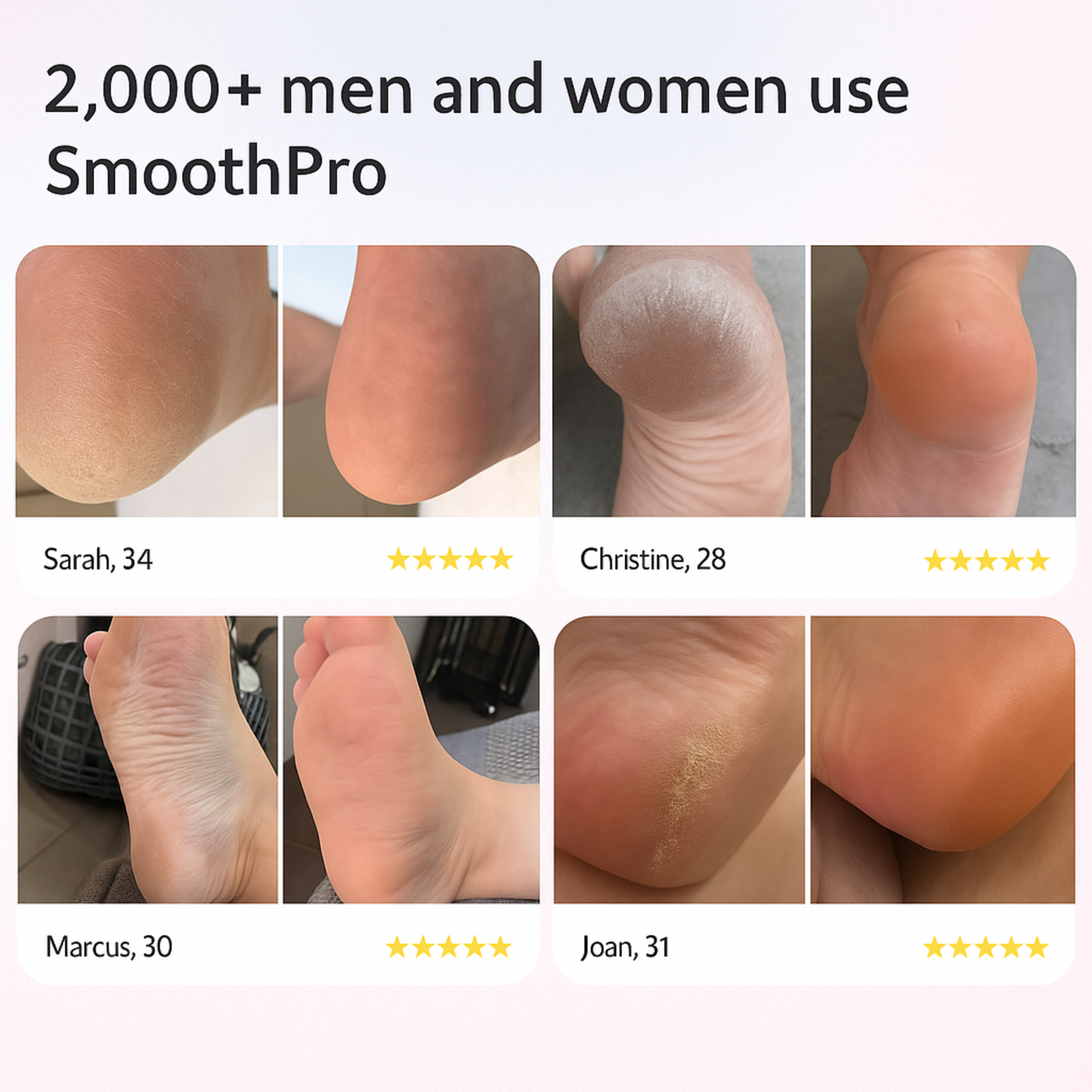 SmoothPro Foot Smoother